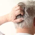 Itchy Skin in Seniors: Important Information You Need to Know